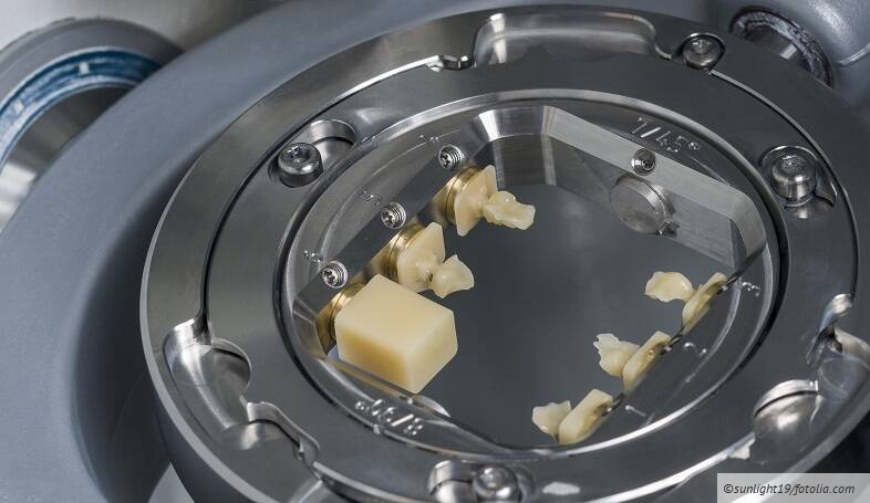 Die vollständige zahntechnische Abrechnung von CAD/CAM und 3D-Druck