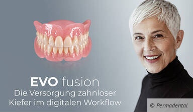 Die Versorgung zahnloser Kiefer im digitalen Workflow