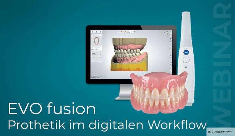 EVO fusion – digital hergestellte Prothetik kombiniert mit etablierten klinischen Protokollen