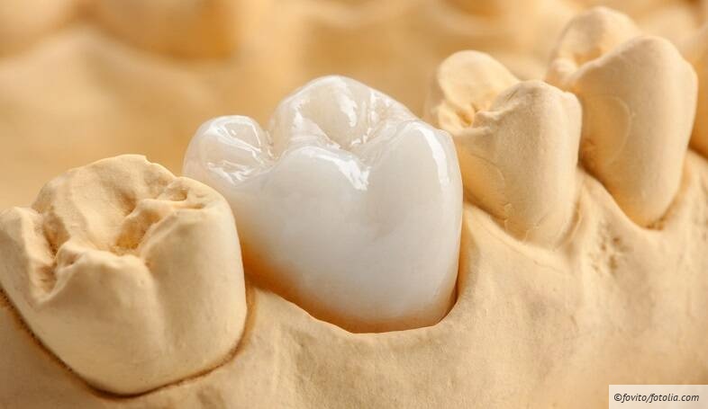 Zahntechnische Abrechnung BEL/beb für Einsteiger