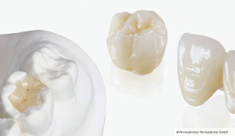 Auswahl der richtigen Kronen und Brücken und deren Befestigung