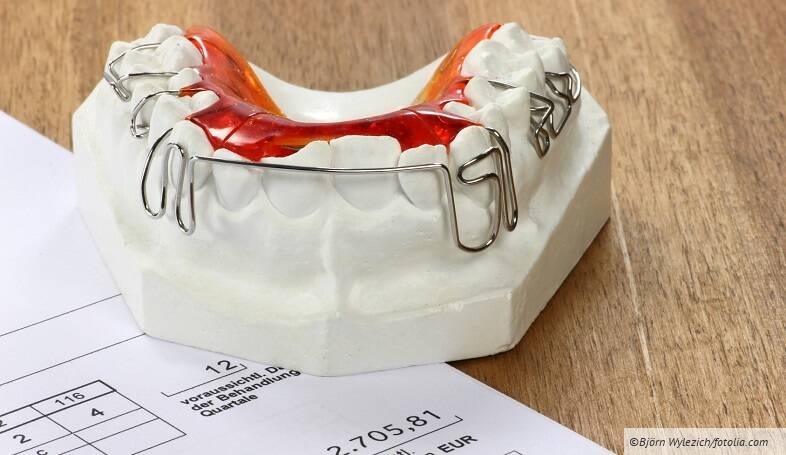 KFO: Die Abrechnung von kieferorthopädischen Privatleistungen