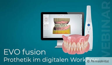 EVO fusion - digital hergestellte Prothetik kombiniert mit etablierten klinischen Protokollen