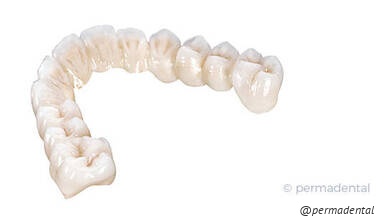 Metallfreie Versorgung - Kronen, Brücken oder Inlay