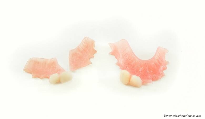 Abrechnung von Reparaturen am Zahnersatz