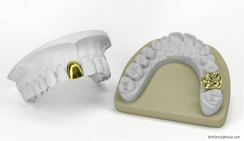 Zahntechnische Abrechnung BEL/beb für Profis