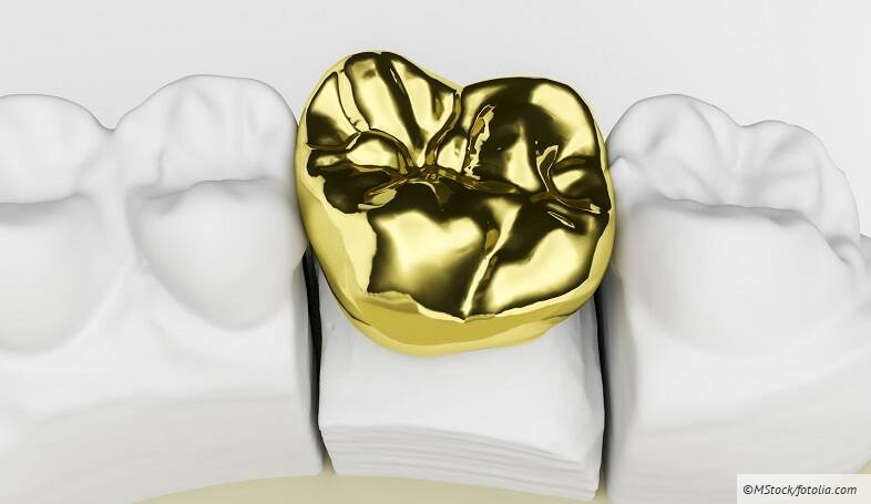 Zahntechnische Abrechnung BEL/beb für Fortgeschrittene