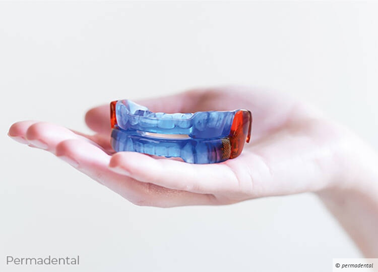 Die Unterkieferprotrusionsschiene für Patienten der GKV